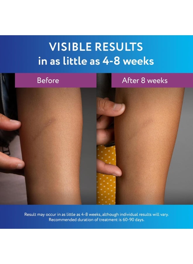 سكار أواي جل ندبات سيليكون طبي 100% من سكاراوي للوجه والجسم والندوب الجراحية والحروق والندبات التضخمية والكيليات وعلاج ندبات حب الشباب، 0.71 أوقية (20 جرام) - Image 5